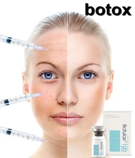 NABOTA 100U | Purified Botulinum Toxin Type A Complax