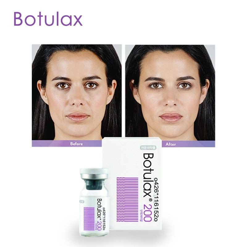Botulax 200u  Injection Anti Aging Directly Supply Best Seller For Face Body Frown