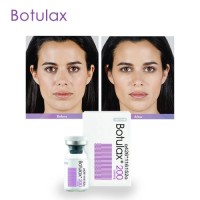 Botulax 200u  Injection Anti Aging Directly Supply Best Seller For Face Body Frown