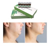Dissolving Babyface Belkyra Lipo Lab Red Ampoules Aqualyx Babyface Ampoule