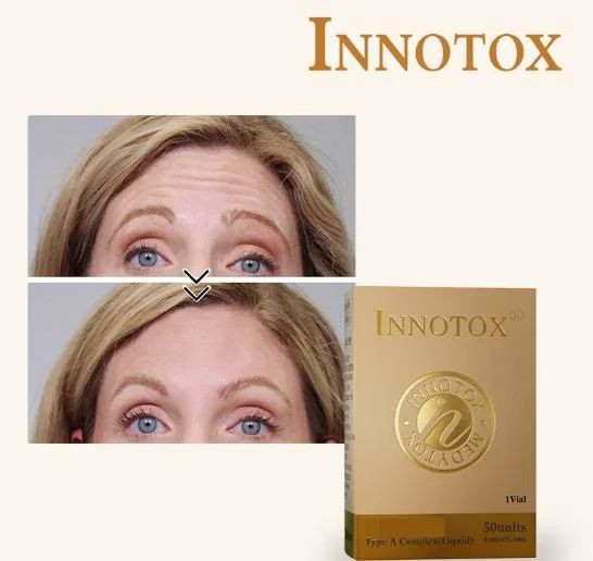 Innotox 50u   botulinum toxin type A Nabota Toxina Botulinica