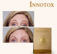 Innotox 50u   botulinum toxin type A Nabota Toxina Botulinica