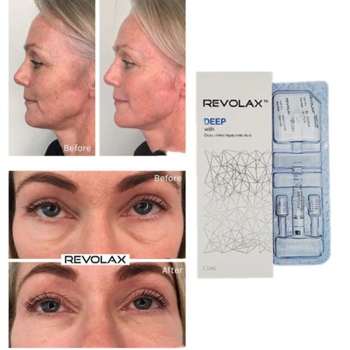 revolax filler