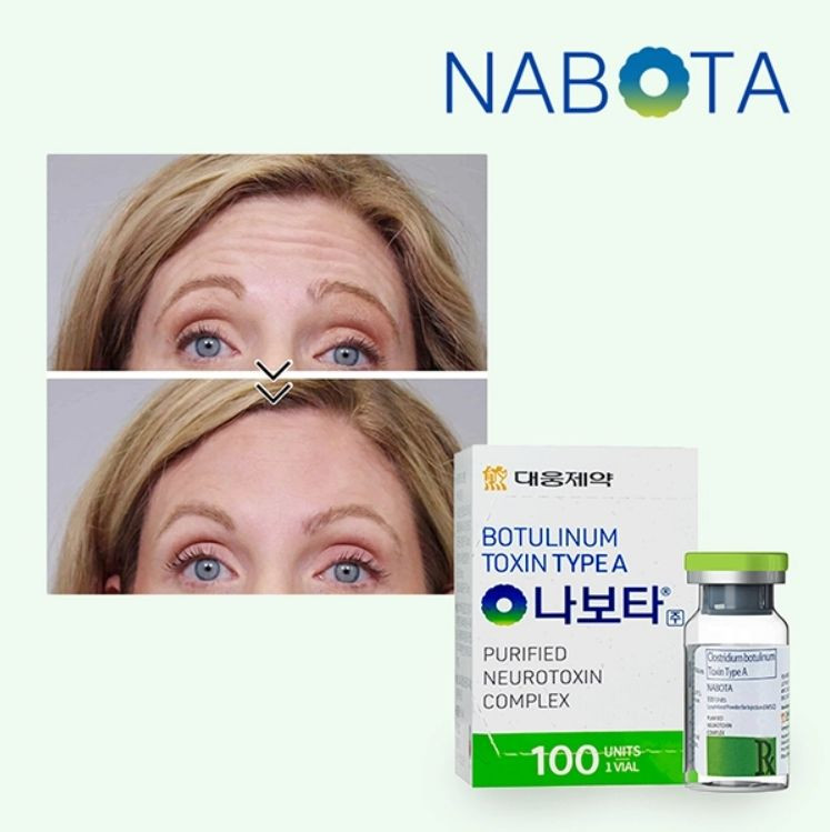 Nabota 100u | botulinum toxin type A Nabota Toxina Botulinica