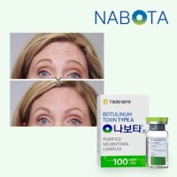 Nabota 100u | botulinum toxin type A Nabota Toxina Botulinica