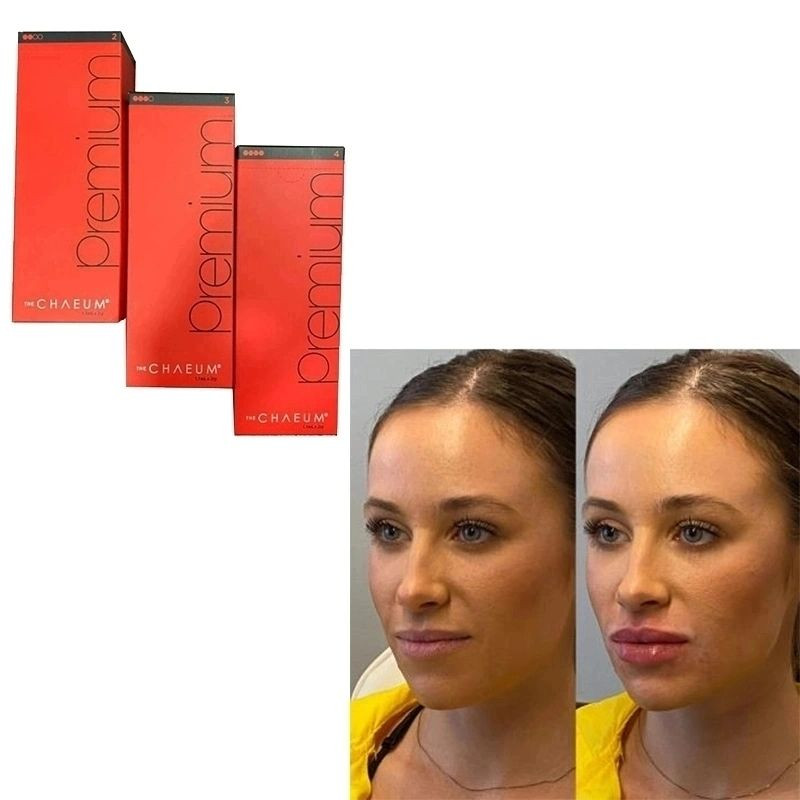 Best The Chaeum Premium No. 1234 Hyaluronic Acid Ha Dermal Filler