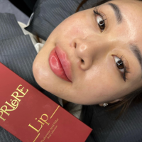 Top Selling Priere Lip Fillers Nourish Hyaluronic Acid Dermal Filler Ha Filler Contains Vitamins for Lips Enhancement